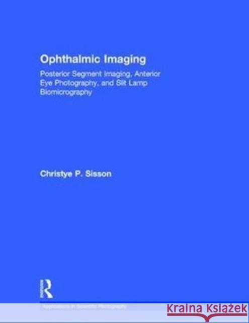 Ophthalmic Imaging: Posterior Segment Imaging, Anterior Eye Photography, and Slit Lamp Biomicrography Peres, Michael 9781138885998 Taylor and Francis
