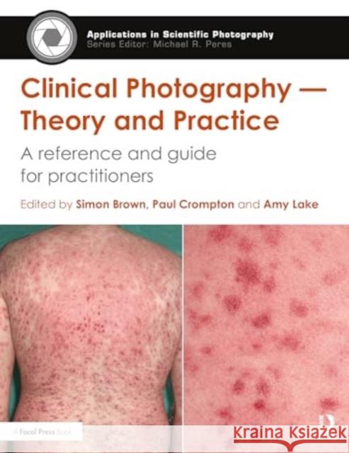 Medical Photography: Theory and Practice of Contemporary Clinical Photography Paul Crompton Amy Lake 9781138891647 Routledge