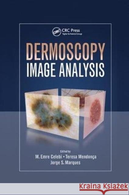 Dermoscopy Image Analysis M. Emre Celebi (Louisiana State Universi Teresa Mendonca (Universidade do Porto,  Jorge S. Marques (Instituto Superior T 9781138892873 CRC Press