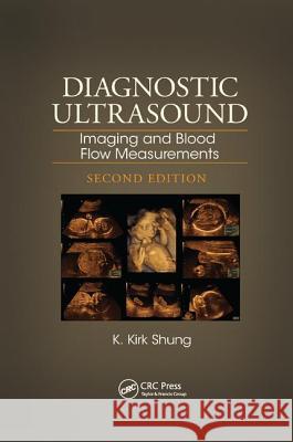 Diagnostic Ultrasound: Imaging and Blood Flow Measurements, Second Edition K. Kirk Shung 9781138892880 CRC Press