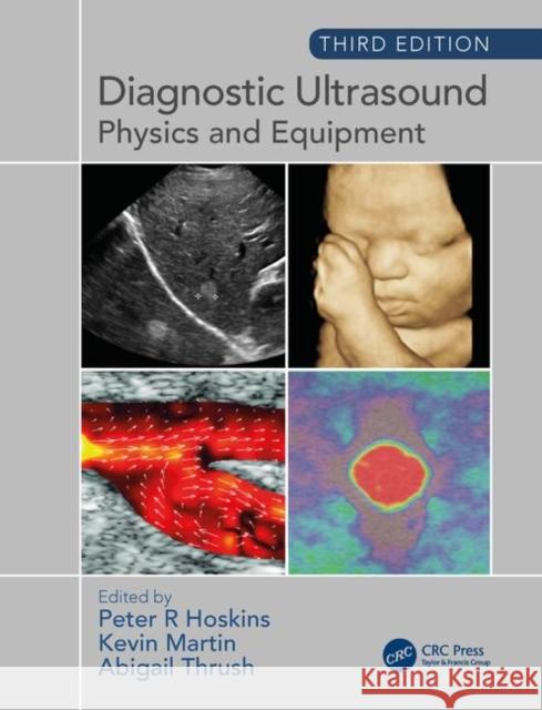 Diagnostic Ultrasound, Third Edition: Physics and Equipment Peter R. Hoskins Kevin Martin Abigail Thrush 9781138892934 Taylor & Francis Ltd