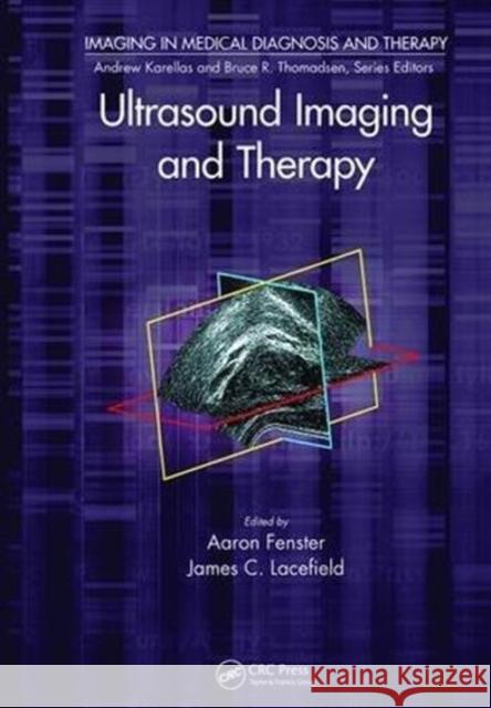 Ultrasound Imaging and Therapy Aaron Fenster James C. Lacefield 9781138894358