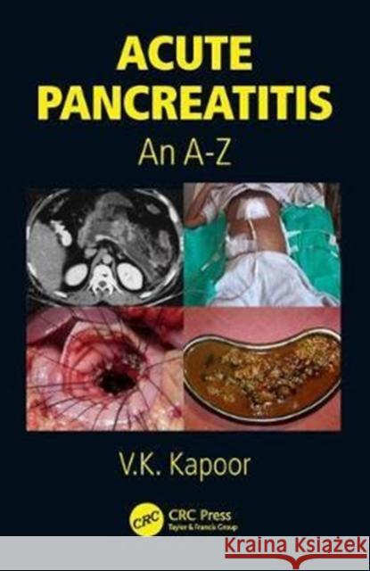 Acute Pancreatitis: An A-Z V. K. Kapoor 9781138894976 CRC Press