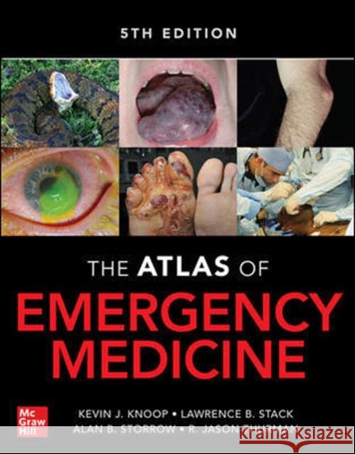 Atlas of Emergency Medicine 5th Edition Kevin J. Knoop Lawrence B. Stack Alan B. Storrow 9781260134940 McGraw-Hill Education / Medical