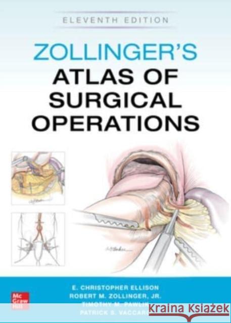 Zollinger's Atlas of Surgical Operations, Eleventh Edition Robert Zollinger E. Ellison 9781260440850