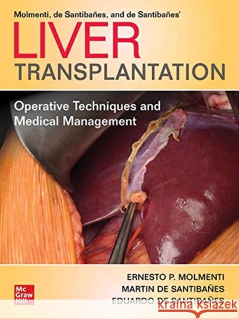 Liver Transplantation: Operative Techniques and Medical Management Molmenti, Ernesto P. 9781260462517 McGraw-Hill Education / Medical