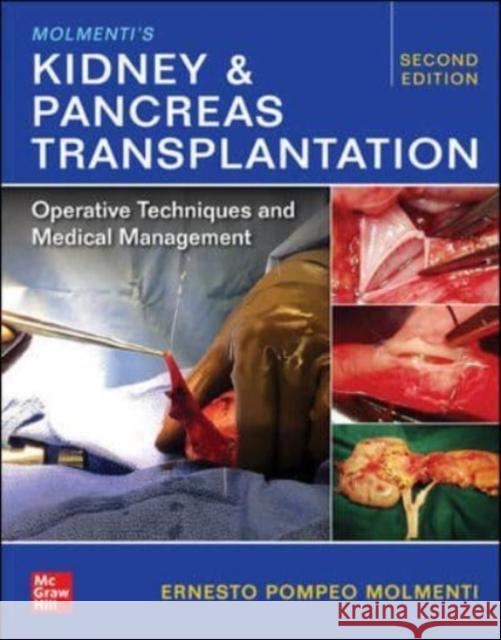 Molmenti's Kidney and Pancreas Transplantation: Operative Techniques and Medical Management Ernesto P. Molmenti 9781260474275 McGraw-Hill Education / Medical