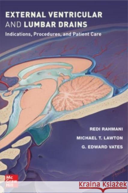 External Ventricular and Lumbar Drains: Indications, Procedures, and Patient Care Edward G Vates 9781264268290 McGraw-Hill Education
