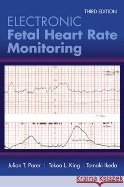 Electronic Fetal Heart Rate Monitoring: The 5-Tier System: The 5-Tier System Parer, Julian T. 9781284090338 Jones & Bartlett Publishers