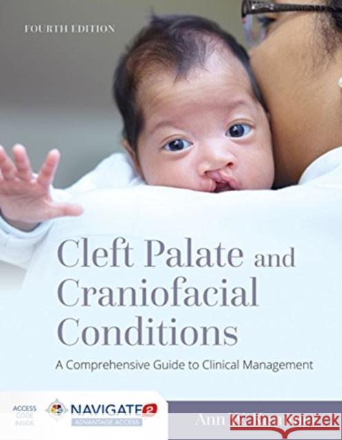 Cleft Palate and Craniofacial Conditions: A Comprehensive Guide to Clinical Management: A Comprehensive Guide to Clinical Management Kummer, Ann W. 9781284149104 Jones & Bartlett Publishers