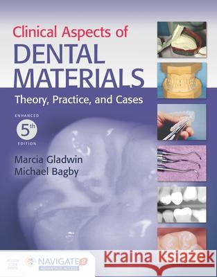 Clinical Aspects of Dental Materials Marcia (gladwin Michael Bagby 9781284221770 Jones & Bartlett Publishers