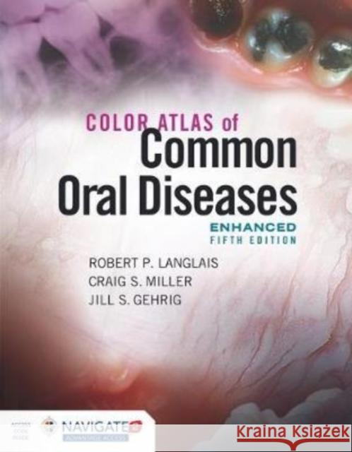 Color Atlas of Common Oral Diseases, Enhanced Edition Robert P. Langlais Jill S. Gehrig 9781284240986 Jones & Bartlett Publishers