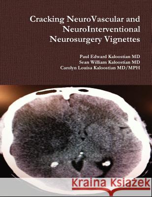 Cracking NeuroVascular and NeuroInterventional Neurosurgery Vignettes Kaloostian, Paul Edward 9781300034650 Lulu.com