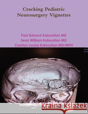 Cracking Pediatric Neurosurgery Vignettes Paul Edward Kaloostia Sean William Kaloostia Carolyn Louisa Kaloostia 9781300174899 Lulu.com