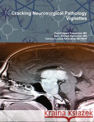 Cracking Neurosurgical Pathology Vignettes Paul Edward Kaloostia Sean William Kaloostia Carolyn Louisa Kaloostia 9781300688006