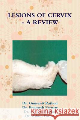 Lesions of Cervix - A Review Dr Gunvanti Rathod Dr Pragnesh Parmar 9781312108165 Lulu.com