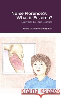 Nurse Florence(R), What is Eczema? Michael Dow, Lorie Brooker 9781312225251 Lulu.com