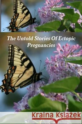 The Untold Stories Of Ectopic Pregnancies Sexton, Cindy 9781312367654 Lulu.com