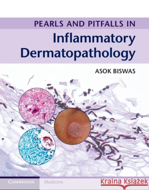 Pearls and Pitfalls in Inflammatory Dermatopathology Asok Biswas   9781316605998