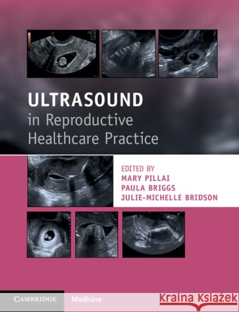 Ultrasound in Reproductive Healthcare Practice Mary Pillai Paula Briggs Julie-Michelle Bridson 9781316609736 Cambridge University Press
