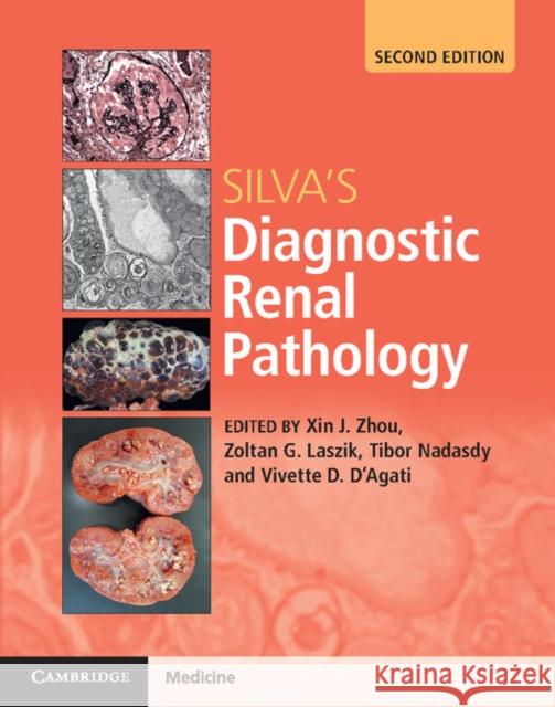 Silva's Diagnostic Renal Pathology Xin Jin Zhou Zoltan G. Laszik Tibor Nadasdy 9781316613986 Cambridge University Press