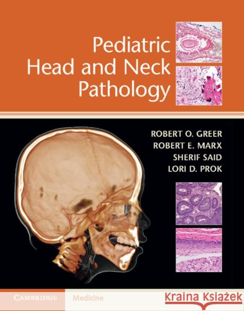 Pediatric Head and Neck Pathology Robert O. Greer Robert E. Marx Sherif Said 9781316613993 Cambridge University Press