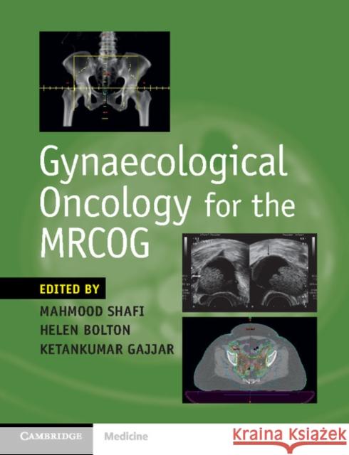 Gynaecological Oncology for the Mrcog Mahmood Shafi Helen Bolton Ketankumar Gajjar 9781316638712 Cambridge University Press