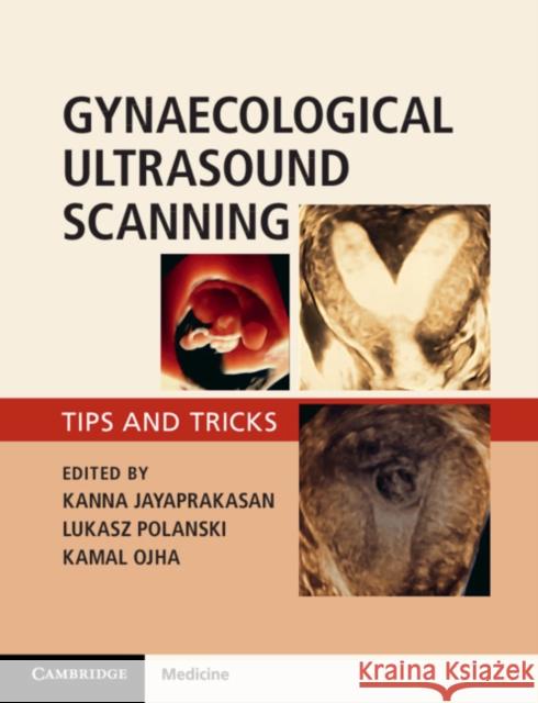 Gynaecological Ultrasound Scanning: Tips and Tricks Jayaprakasan, Kanna 9781316645178