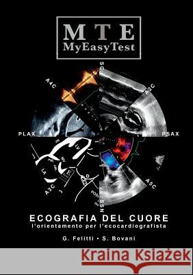 Ecografia Del Cuore - Myeasytest Giuseppe Felitti, Stefano Bovani 9781326796136