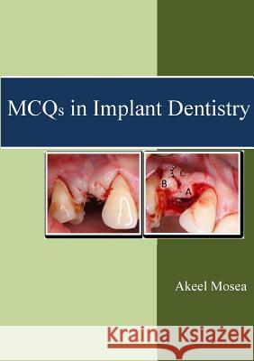 MCQs in Implant Dentistry Mosea, Akeel 9781326883195