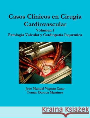 Casos Clinicos En Cirugia Cardiovascular. Volumen I. Patologia Valvular Y Cardiopatia Isquemica Jose Manuel Vigna Tomas Daroc 9781329414921