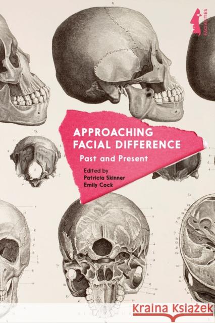 Approaching Facial Difference: Past and Present Emily Cock David H. Jones Garthine Walker 9781350028296 Bloomsbury Academic