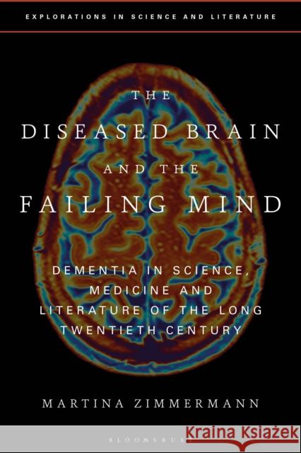 The Diseased Brain and the Failing Mind: Dementia in Science, Medicine and Literature of the Long Twentieth Century Martina Zimmermann Anton Kirchhofer Janine Rogers 9781350121805 Bloomsbury Academic