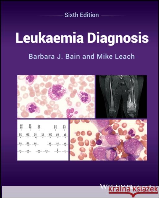 Leukaemia Diagnosis, Sixth Edition Mike (Gartnavel General Hospital, Glasgow, UK) Leach 9781394218585