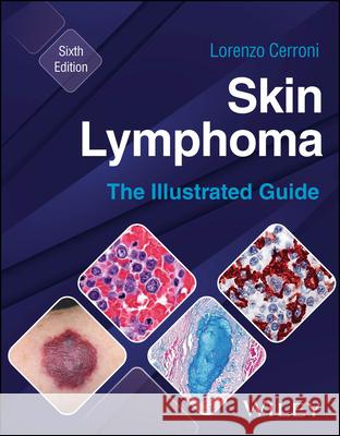 Skin Lymphoma Lorenzo (Medical University of Graz, Austria) Cerroni 9781394235483 