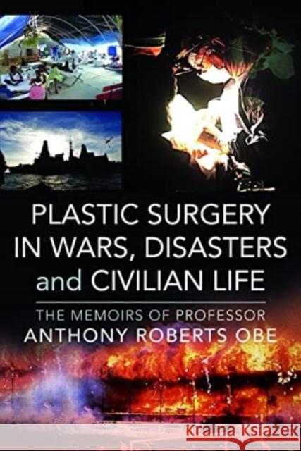 Plastic Surgery in Wars, Disasters and Civilian Life: The Memoirs of Professor Anthony Roberts OBE Anthony Roberts 9781399068482