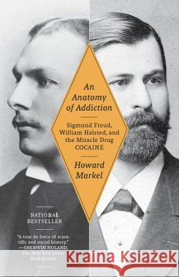 An Anatomy of Addiction: Sigmund Freud, William Halsted, and the Miracle Drug Cocaine Markel, Howard 9781400078790