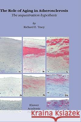 The Role of Aging in Atherosclerosis: The Sequestration Hypothesis Tracy, R. E. 9781402012235 Kluwer Academic Publishers