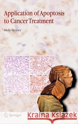 Application of Apoptosis to Cancer Treatment Mels Sluyser Mels Sluyser 9781402033032