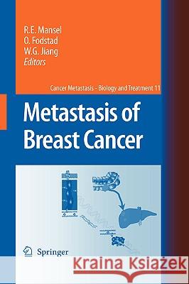 Metastasis of Breast Cancer  9781402058660 KLUWER ACADEMIC PUBLISHERS GROUP