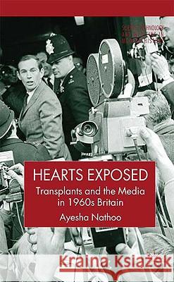 Hearts Exposed: Transplants and the Media in 1960s Britain Nathoo, A. 9781403987303 Palgrave MacMillan