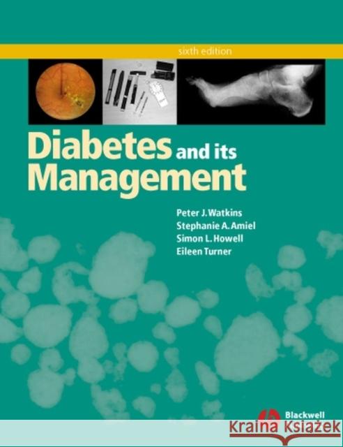Diabetes and Its Management Peter J. Watkins Stephanie A. Amiel Simon L. Howell 9781405107259