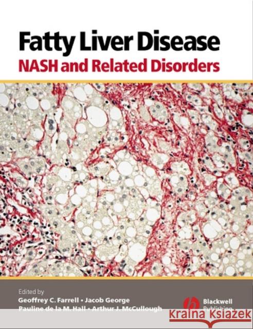 Fatty Liver Disease: Nash and Related Disorders Farrell, Geoffrey C. 9781405112925 Blackwell Publishers