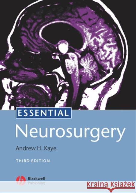 Essential Neurosurgery Andrew H. Kaye 9781405116411 Blackwell Publishers