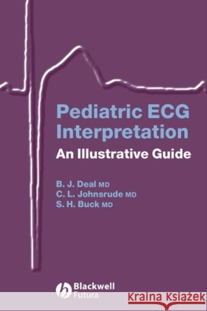 Pediatric ECG Interpretation: An Illustrative Guide [With CD] Deal, Barbara J. 9781405117302 Blackwell Publishers