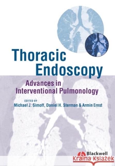 Thoracic Endoscopy: Advances in Interventional Pulmonology Simoff, Michael J. 9781405122047 BLACKWELL PUBLISHING LTD