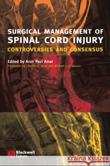 Surgical Management of Spinal Cord Injury: Controversies and Consensus Amar, Arun Paul 9781405122061