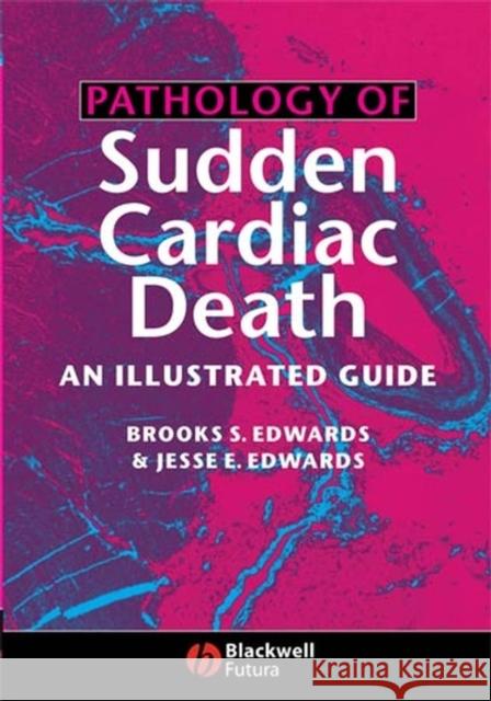 Pathology of Sudden Cardiac Death: An Illustrated Guide Edwards, Jesse E. 9781405122122 Blackwell Futura