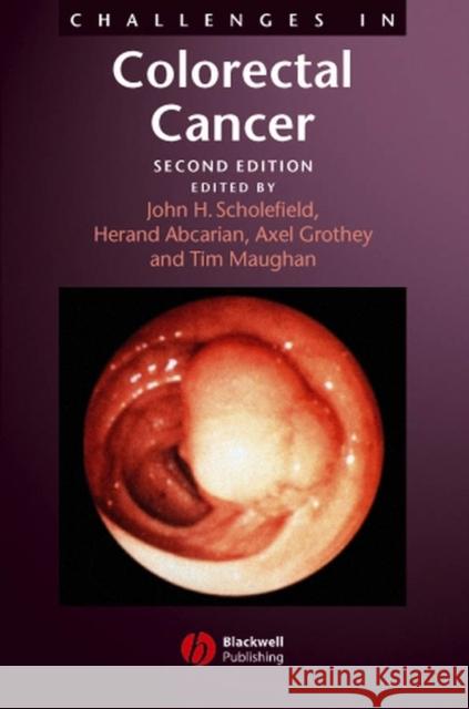 Challenges in Colorectal Cancer Tim Maughan John Scholefield Herand Abcarian 9781405127066 Blackwell Publishers