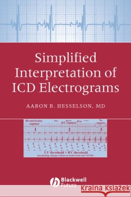 Simplified Interpretation of ICD Electrograms Aaron B. Hesselson Aaron Hesselson 9781405127318 Blackwell/Futura